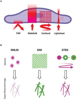 Super-Resolution Imaging Approaches for Quantifying F-Actin in Immune Cells